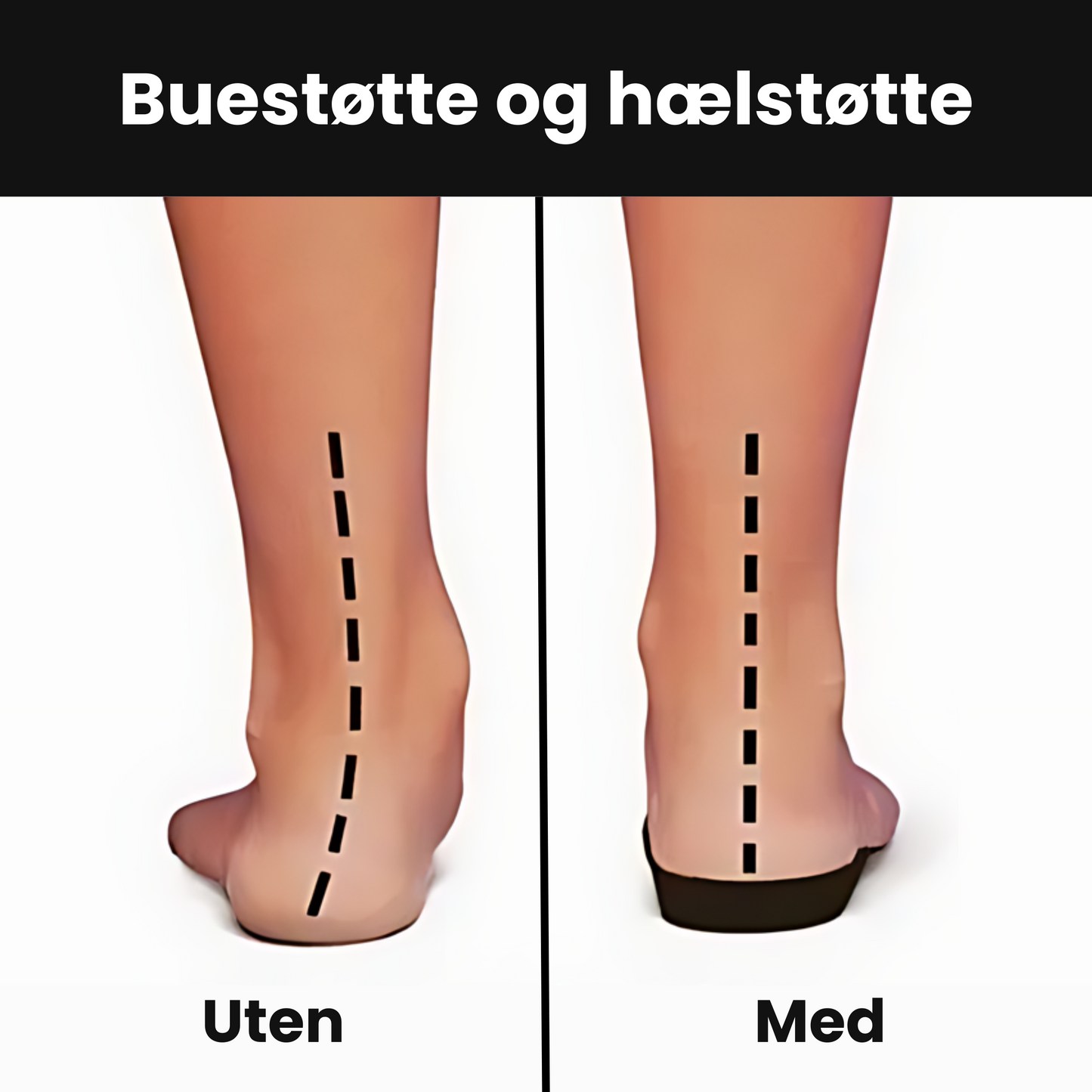 Ortopediske Slip-on Sko
